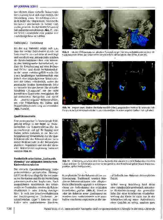 Vorschauseite 5: Intraoperative Navigation und computerassistierte Chirurgie in der MKG-Chirurgie