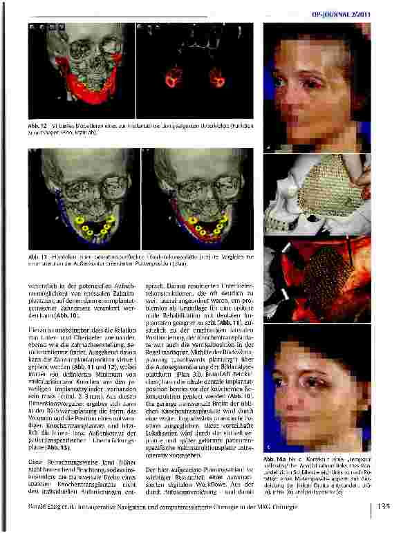 Vorschauseite 6: Intraoperative Navigation und computerassistierte Chirurgie in der MKG-Chirurgie