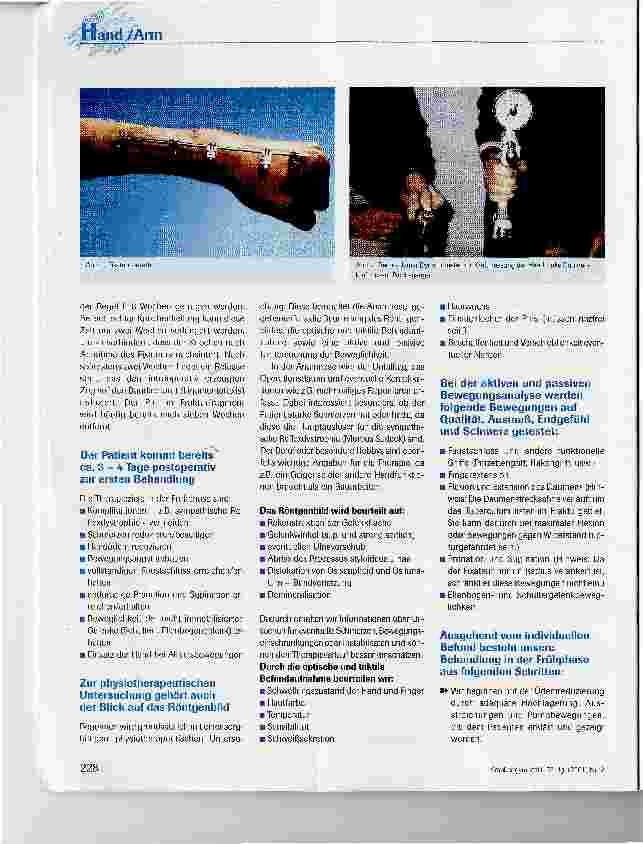 Vorschauseite 2: Physiotherapeutische Behandlung nach distaler Radiusfraktur