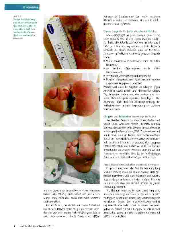 Vorschauseite 3: MRSA: Multiresistente Bakterien auch ambulant richtig bekämpfen