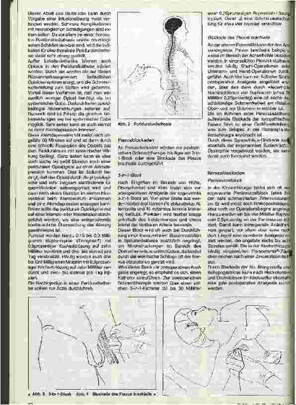 Vorschauseite 4: Postoperative Schmerztherapie