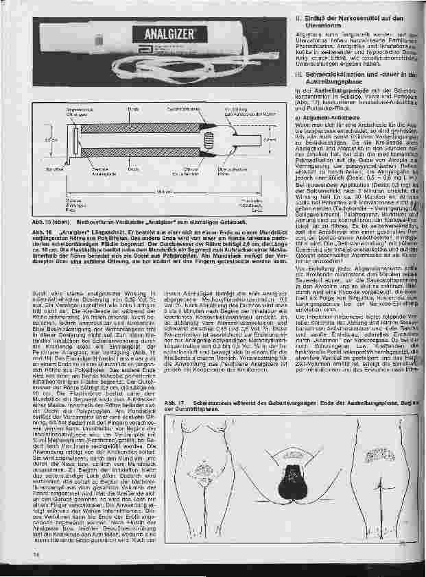 Vorschauseite 3: Einführung in die Anästhesie 24. Folge: Analgesie und Anästhesie in der Geburtshilfe 2. Teil