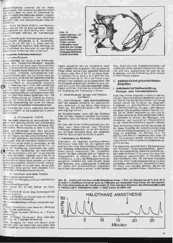 Vorschauseite 4: Einführung in die Anästhesie 24. Folge: Analgesie und Anästhesie in der Geburtshilfe 2. Teil