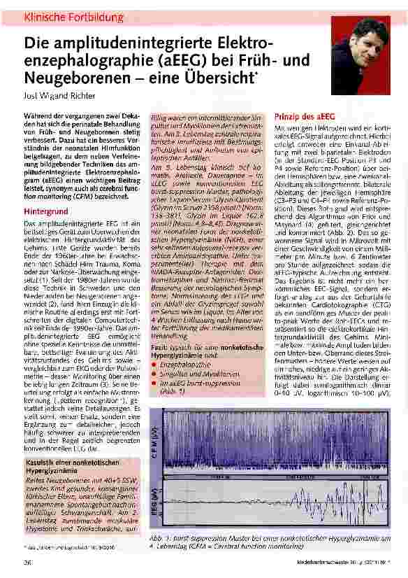 Vorschauseite 1: Die amplitudenintegrierte Elektro-enzephalographie (aEEG) bei Frühund Neugeborenen - eine Übersicht