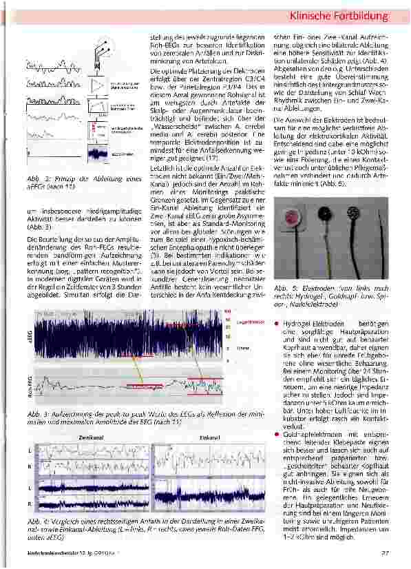Vorschauseite 2: Die amplitudenintegrierte Elektro-enzephalographie (aEEG) bei Frühund Neugeborenen - eine Übersicht