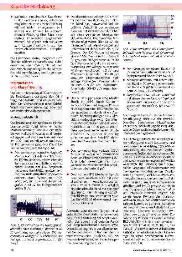 Vorschauseite 3: Die amplitudenintegrierte Elektro-enzephalographie (aEEG) bei Frühund Neugeborenen - eine Übersicht