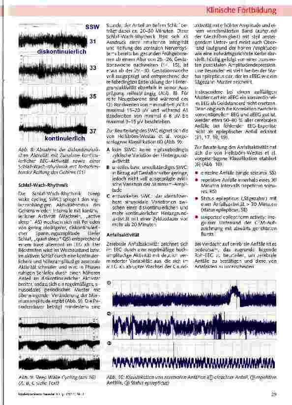 Vorschauseite 4: Die amplitudenintegrierte Elektro-enzephalographie (aEEG) bei Frühund Neugeborenen - eine Übersicht