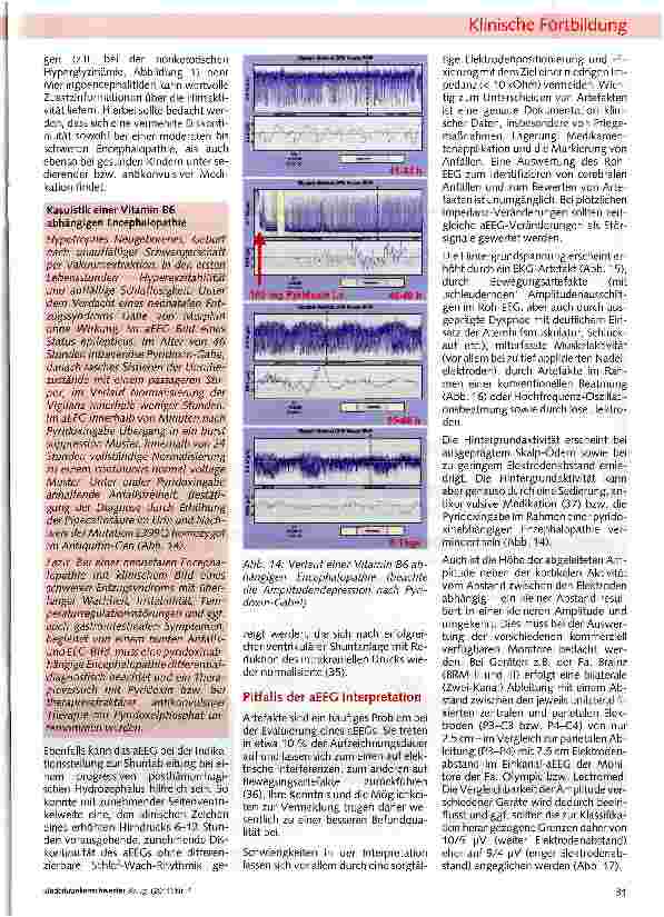 Vorschauseite 6: Die amplitudenintegrierte Elektro-enzephalographie (aEEG) bei Frühund Neugeborenen - eine Übersicht
