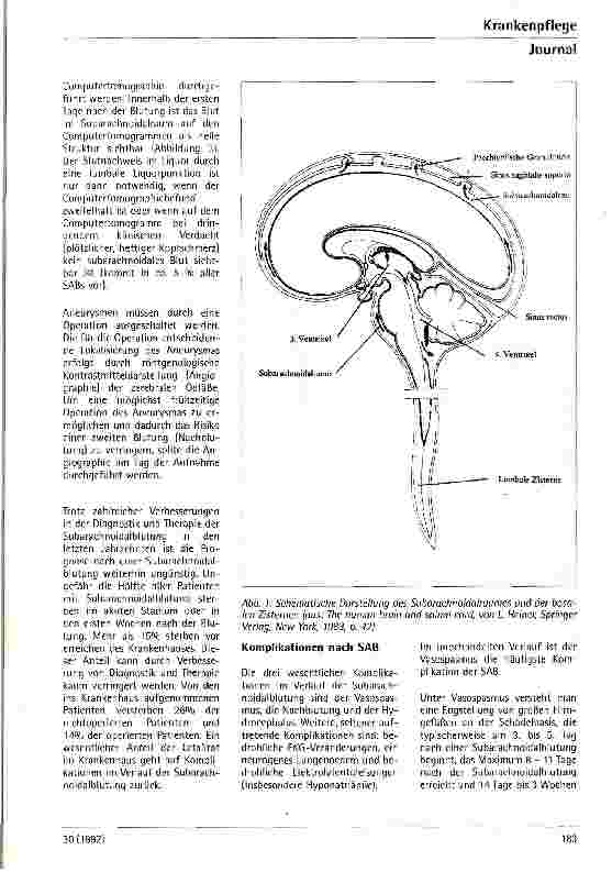 Vorschauseite 2: Subarachnoidalblutung - Pathophysiologie, Symptome und Therapie