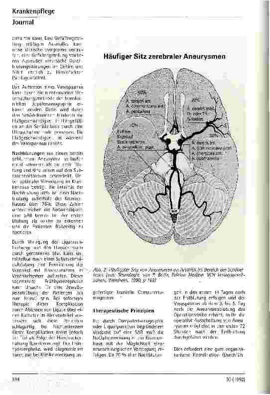 Vorschauseite 3: Subarachnoidalblutung - Pathophysiologie, Symptome und Therapie