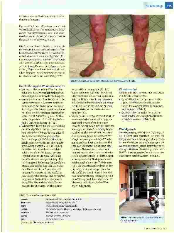 Vorschauseite 4: Wundversorgung in der Palliative Care (Teil 1)