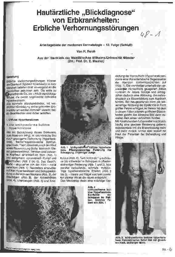 Vorschauseite 1: Hautärztliche Blickdiagnose von Erbkranheiten: Erbliche Verhornungsstörungen