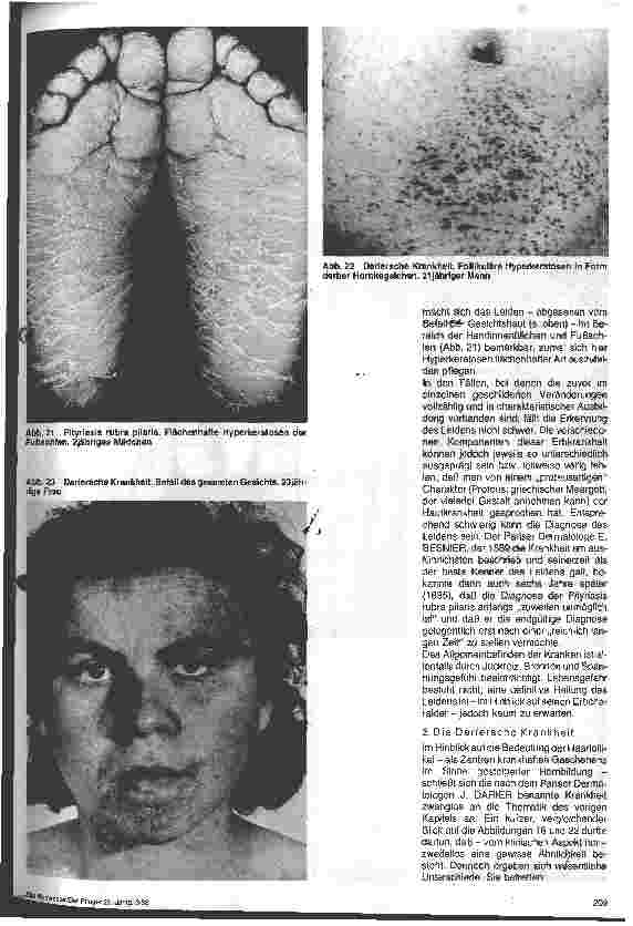 Vorschauseite 5: Hautärztliche Blickdiagnose von Erbkranheiten: Erbliche Verhornungsstörungen