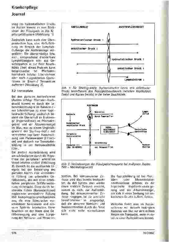 Vorschauseite 3: Aszites - Pathophysiologie, klinisches Bild und therapeutische Beeinflußbarkeit