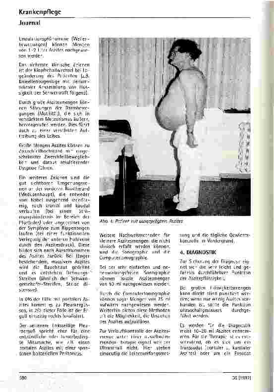 Vorschauseite 5: Aszites - Pathophysiologie, klinisches Bild und therapeutische Beeinflußbarkeit