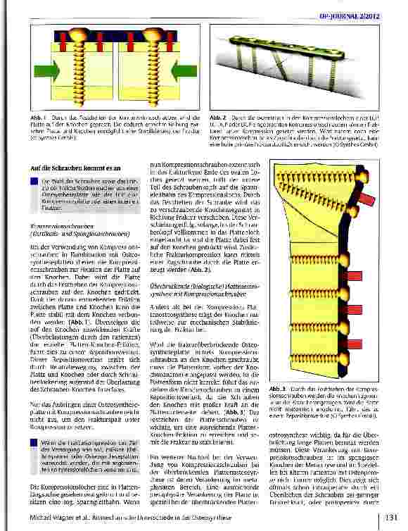 Vorschauseite 2: Biomechanische Unterschiede in der Osteosynthese zwischen Kompressionsplatten und Überbrückungsplatten