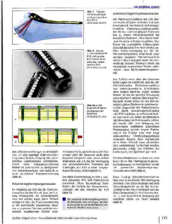 Vorschauseite 4: Biomechanische Unterschiede in der Osteosynthese zwischen Kompressionsplatten und Überbrückungsplatten