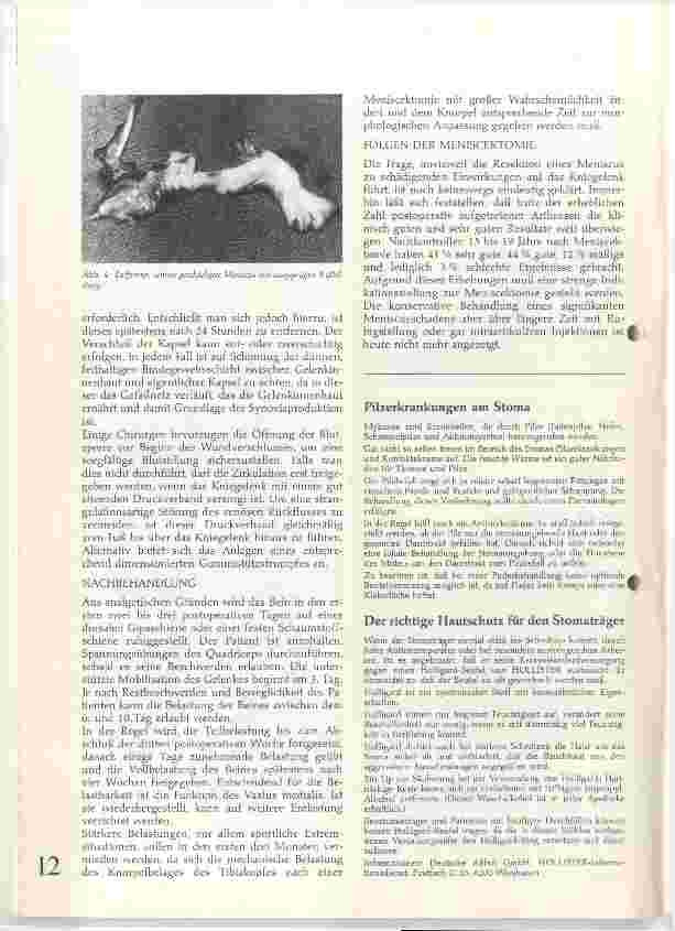 Vorschauseite 4: Meniscuslaesionen