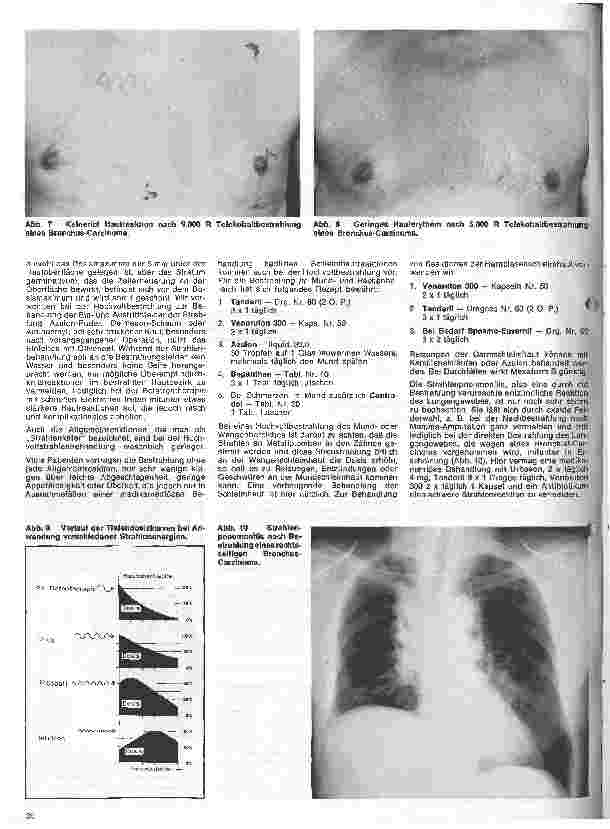 Vorschauseite 3: Radiologie // Eine Einführung für Krankenschwestern u. Krankenpfleger 5. Folge: Nebenwirkungen der Strahlenbehandlung