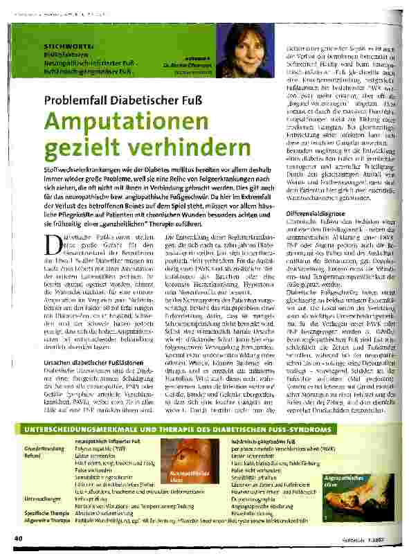 Vorschauseite 1: Amputationen gezielt verhindern