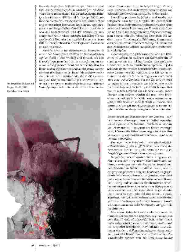 Vorschauseite 3: Selbstverlust und Dissoziation bei dementieilen Erkrankungen