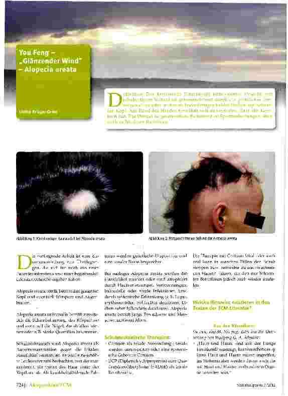 Vorschauseite 1: You Feng Glänzender Wind - Alopecia areata