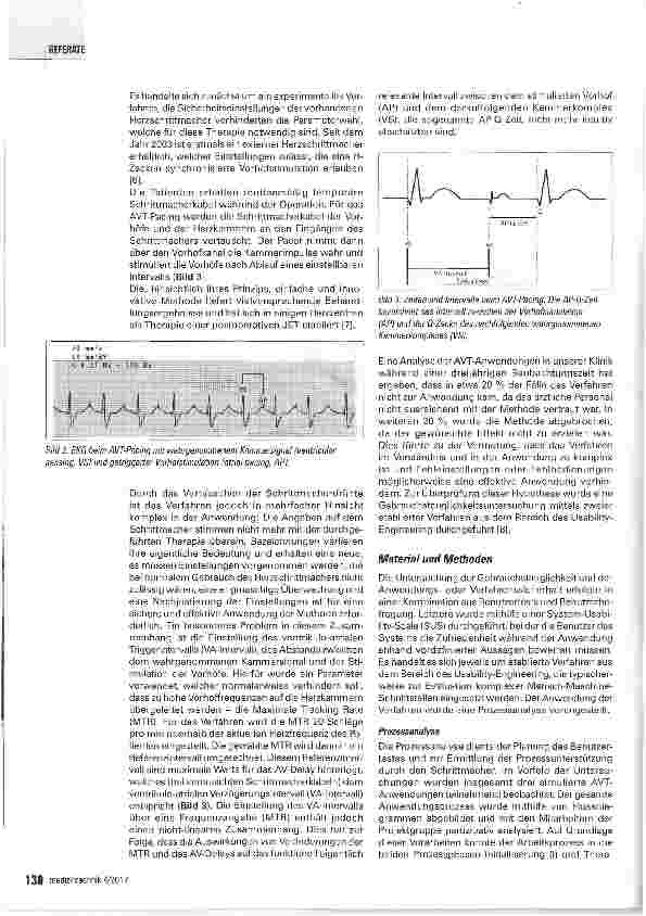 Vorschauseite 2: Untersuchung zur Sicherheit und Effizienz der Anwendung von R-Zacken synchronisierter Vorhofstimulation