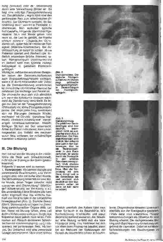Vorschauseite 3: Chirurgische Krankenpflege