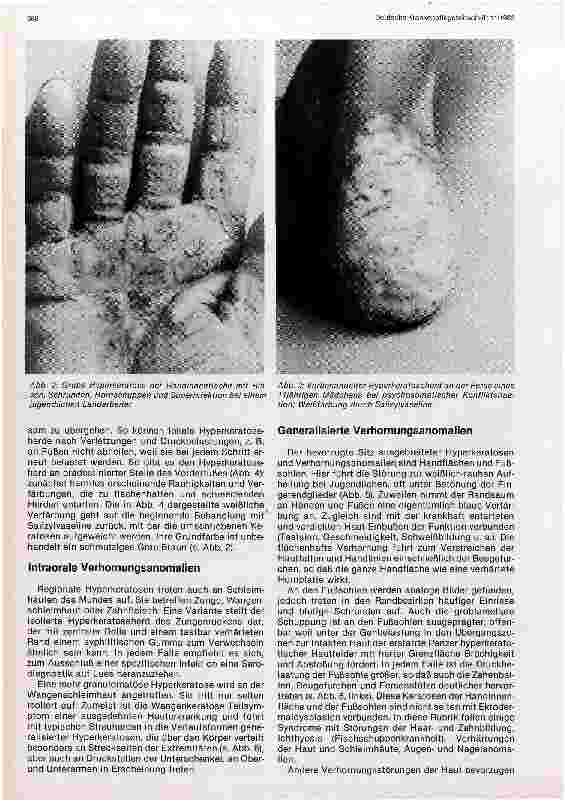 Vorschauseite 2: Verlaufsformen juveniler Hyperkeratosen