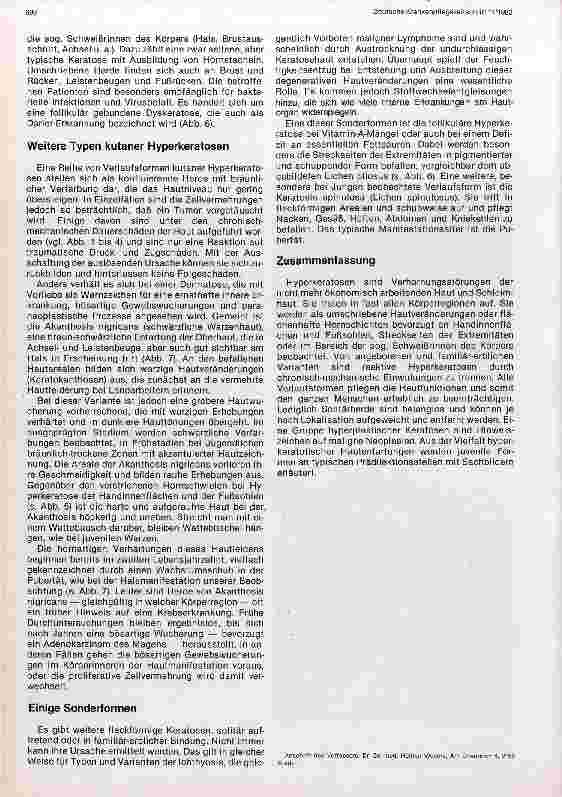 Vorschauseite 4: Verlaufsformen juveniler Hyperkeratosen