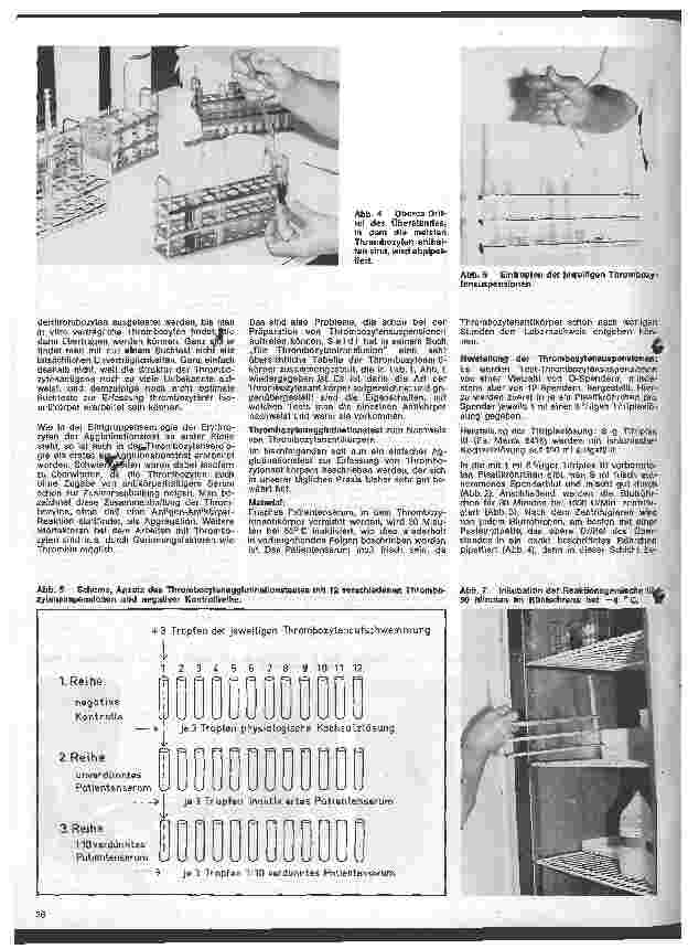 Vorschauseite 3: Transfusionskunde, Blutgruppenserologie und Immunhämatologie 23. Folge: Thrombozyten-Antikörper