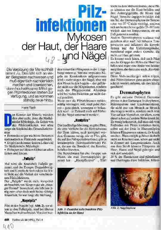 Vorschauseite 1: Pilzinfektionen - Mykosen der Haut, der Haare und Nägel
