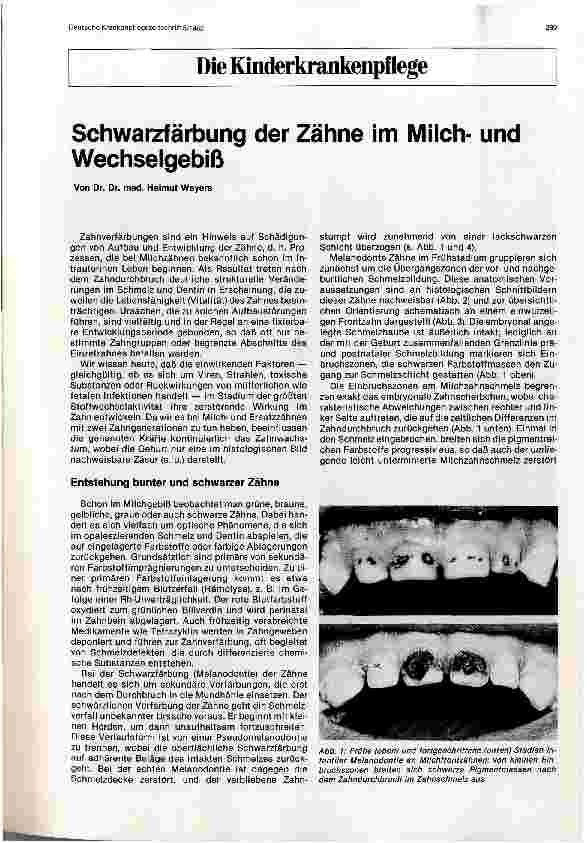 Vorschauseite 1: Schwarzfärbung der Zähne im Milchund Wechselgebiß