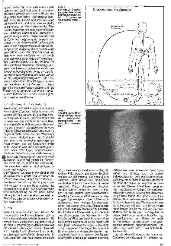 Vorschauseite 2: Wurminfektionen - Dracunculiasis - Paragonimisis