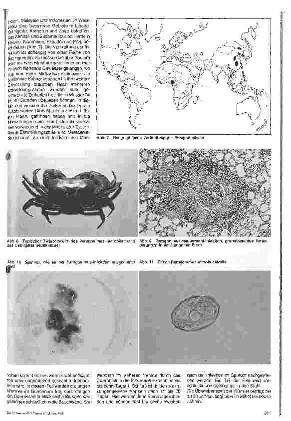 Vorschauseite 4: Wurminfektionen - Dracunculiasis - Paragonimisis