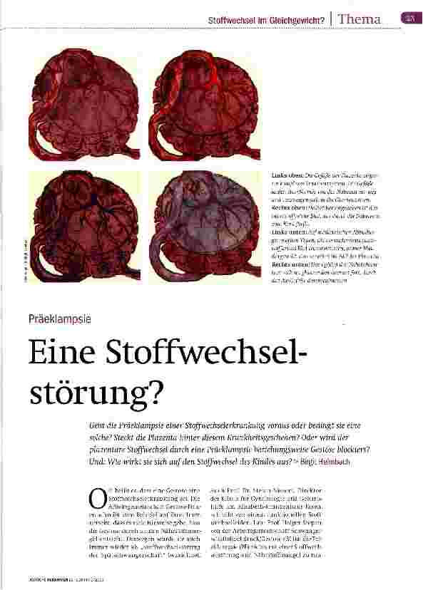 Vorschauseite 1: Eine Stoffwechselstörung?