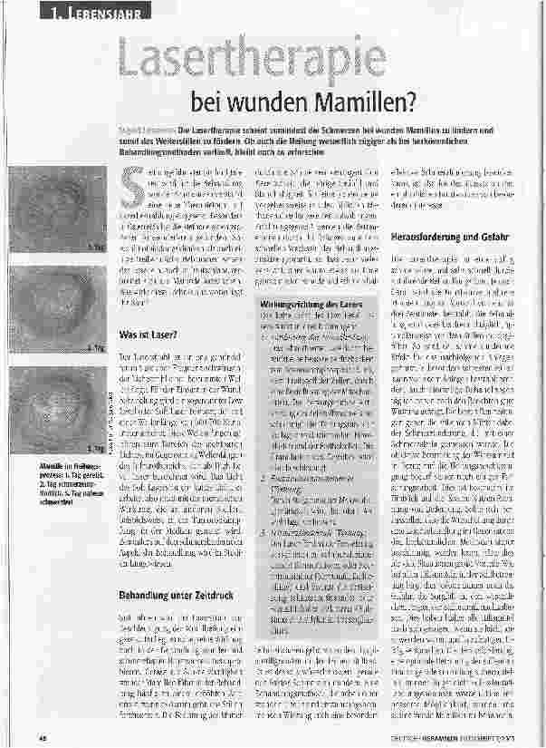 Vorschauseite 1: Lasertherapie bei wunden Mamillen?