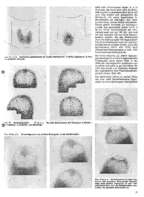 Vorschauseite 4: Radiologie Eine Einführung für Krankenschwestern u. Krankenpfleger 13. Folge: Ergebnisse nuklearmedizinischer Untersuchungen