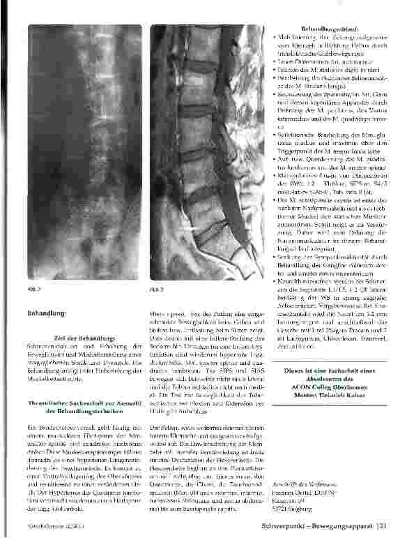 Vorschauseite 2: Chiropraktik, Osteopathie und Neuraltherapie: Behandlungsoptionen bei einem subakuten Bandscheibenprolaps der Lendenwirbelsäule
