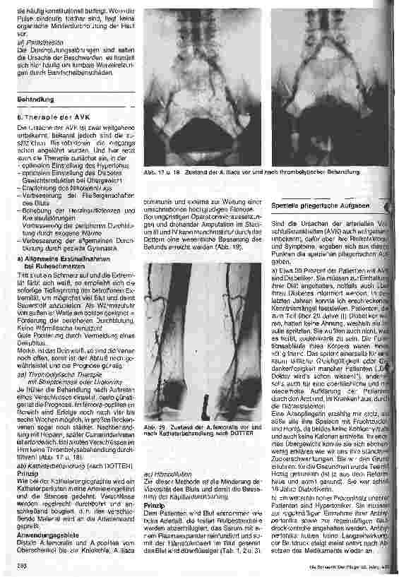 Vorschauseite 4: Gefäßkrankheiten Ursachen - Auswirkungen - Behandlung (2. Teil) Erkrankungen des arteriellen Systems (II) - Spezielle Diagnostik