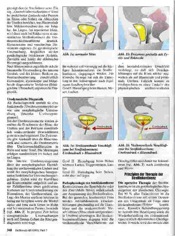 Vorschauseite 2: Harninkontinenz der Frau Eine Volkskrankheit?