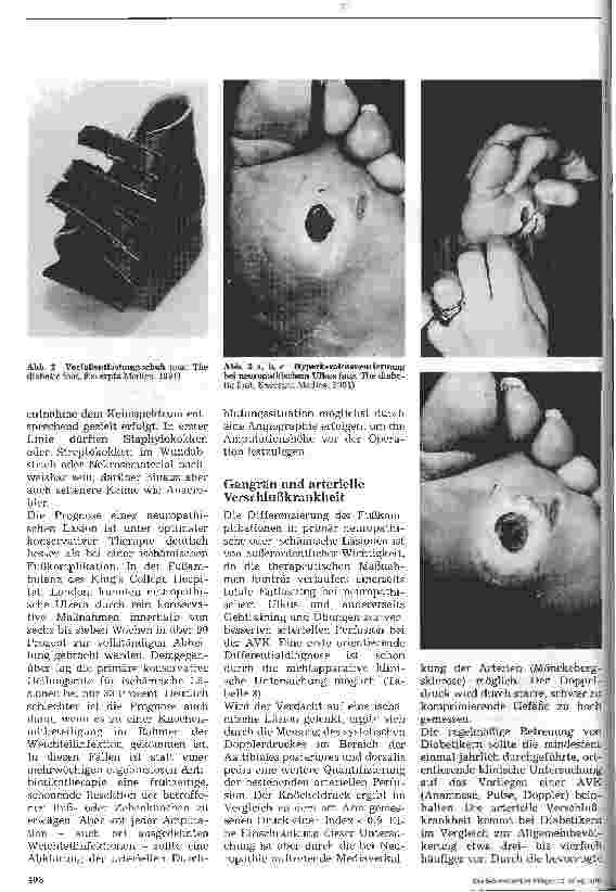 Vorschauseite 3: Fußkomplikationen bei Diabetes Mellitus