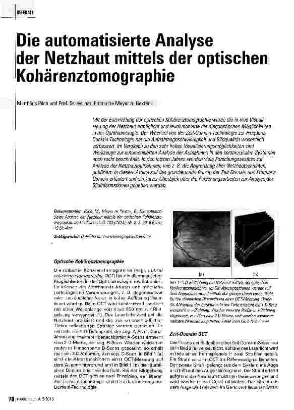 Vorschauseite 1: Die automatisierte Analyse der Netzhaut mittels der optischen Kohärenztomographie