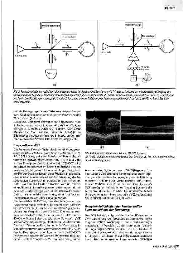 Vorschauseite 2: Die automatisierte Analyse der Netzhaut mittels der optischen Kohärenztomographie