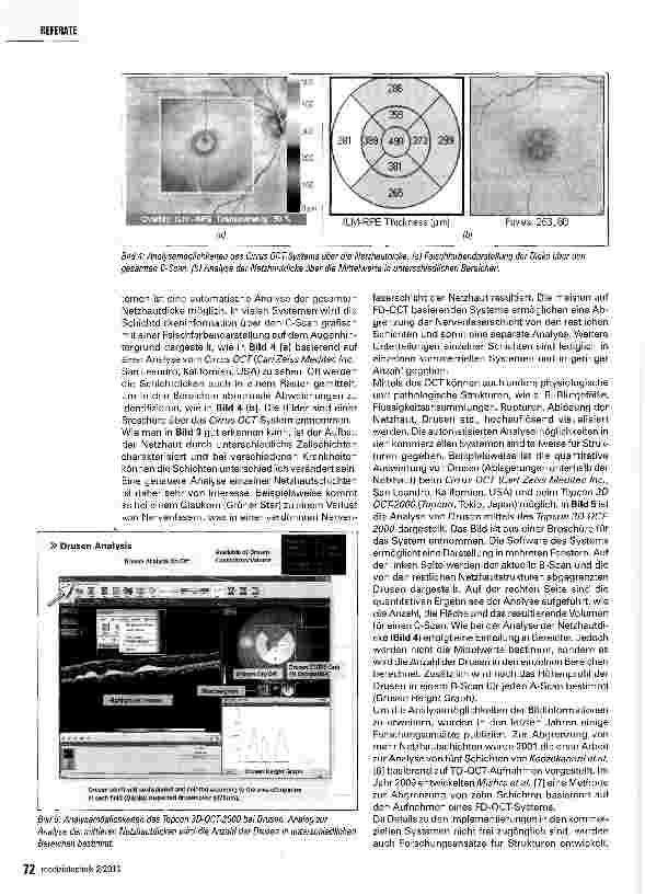 Vorschauseite 3: Die automatisierte Analyse der Netzhaut mittels der optischen Kohärenztomographie