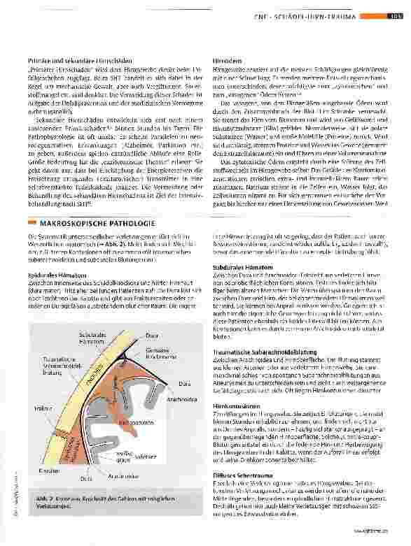 Vorschauseite 3: Klinik und Therapie des Schädel-Hirn-Traumas