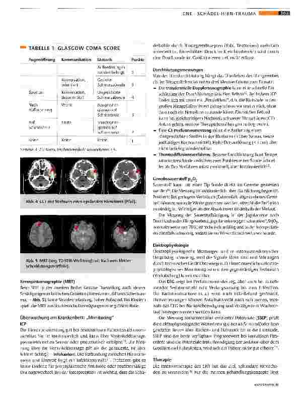 Vorschauseite 5: Klinik und Therapie des Schädel-Hirn-Traumas