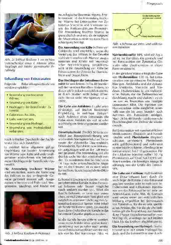 Vorschauseite 3: Wenn etwas daneben läuft... Extravasate als Komplikation der Infusionstherapie