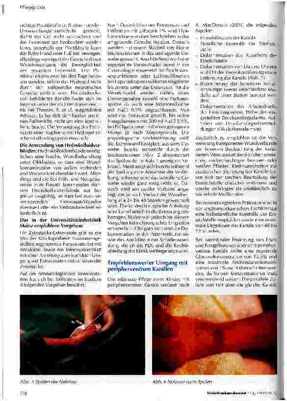 Vorschauseite 4: Wenn etwas daneben läuft... Extravasate als Komplikation der Infusionstherapie