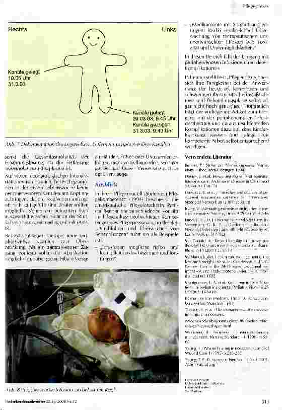 Vorschauseite 5: Wenn etwas daneben läuft... Extravasate als Komplikation der Infusionstherapie